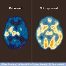 images depressed brain and not